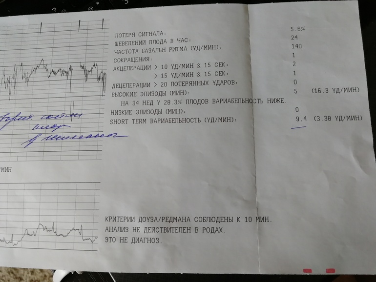 Почему не чувствую шевелений ребенка