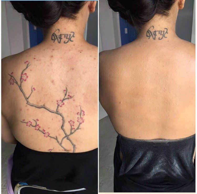 After tattoo. Татуировка камуфляж.