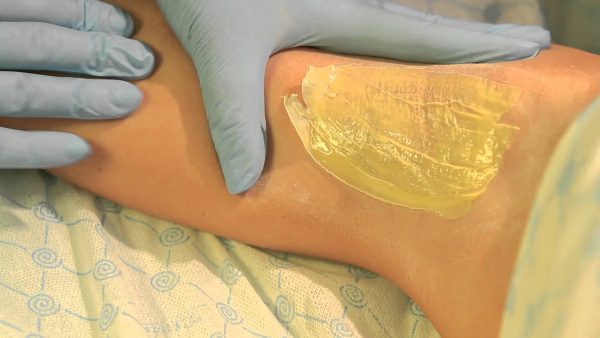 Депиляция подмышки плёночным воском