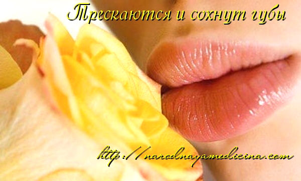 трескаются сохнут шелушаться губы